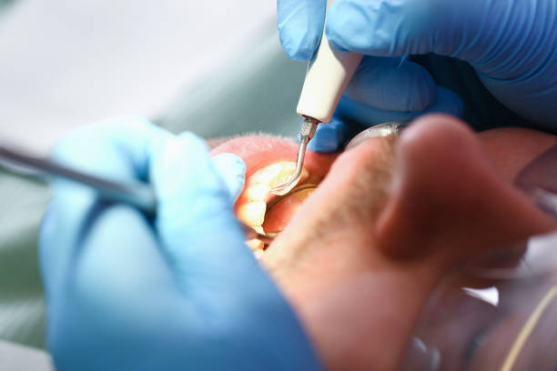 Best Emergency Orthodontic Services in Caro, MI